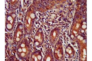 IHC image of ABIN7173439 diluted at 1:400 and staining in paraffin-embedded human small intestine tissue performed on a Leica BondTM system. (TRIM35 antibody  (AA 1-206))