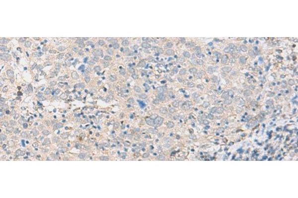 ABHD17B antibody
