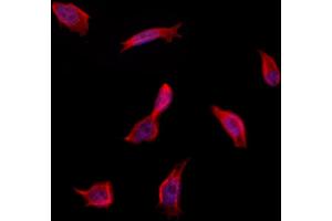 ABIN6262599 and ABIN6273256 staining Hela by IF/ICC.