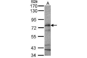 WB Image Sample(30 μg of whole cell lysate) A:HeLa S3, 7. (CPT2 antibody)