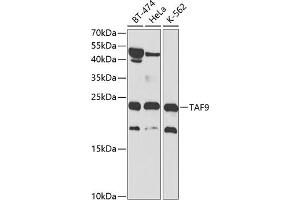 Western blot analysis of extracts of various cell lines, using T antibody (ABIN3015850, ABIN3015851, ABIN1682962 and ABIN6219191) at 1:1000 dilution. (TAF9 antibody  (AA 1-172))