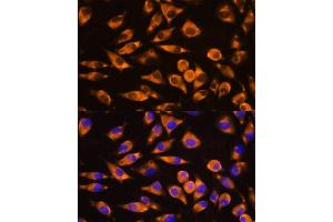 Immunofluorescence analysis of L929 cells using CEP55 antibody (ABIN6127692, ABIN6138423, ABIN6138424 and ABIN6224249) at dilution of 1:100. (CEP55 antibody  (AA 1-260))