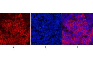 anti-Poly (ADP-Ribose) Polymerase 1 (PARP1) (AA 140-220), (Cleaved-Asp214) antibody