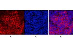 Immunofluorescence analysis of rat spleen tissue. (PARP1 antibody  (Cleaved-Asp214))