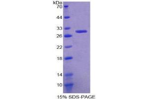 SDS-PAGE (SDS) image for Glutathione S-Transferase theta 1 (GSTT1) (AA 7-240) protein (His tag) (ABIN2125023) (GSTT1 Protein (AA 7-240) (His tag))