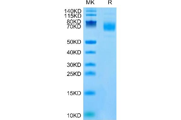 CSPG5 Protein (AA 31-423) (His tag)