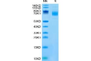 Mouse CSPG5 on Tris-Bis PAGE under reduced condition. (CSPG5 Protein (AA 31-423) (His tag))