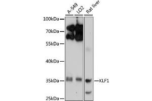 Western blot analysis of extracts of various cell lines, using KLF1 antibody (ABIN6134663, ABIN6142905, ABIN6142906 and ABIN6214882) at 1:1000 dilution. (KLF1 antibody  (AA 1-100))