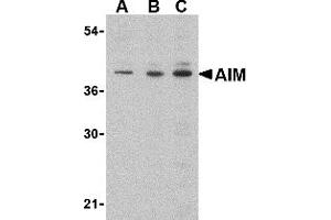 Western Blotting (WB) image for anti-AIM (C-Term) antibody (ABIN1030228) (AIM (C-Term) antibody)