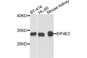 Western blot analysis of extracts of various cell lines, using EIF4E2 antibody. (EIF4E2 antibody)