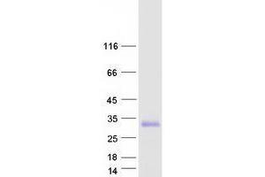 Validation with Western Blot (TMEM98 Protein (Transcript Variant 2) (Myc-DYKDDDDK Tag))