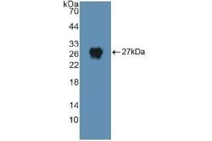 Detection of Recombinant DNM2, Human using Polyclonal Antibody to Dynamin 2 (DNM2) (DNM2 antibody  (AA 533-731))
