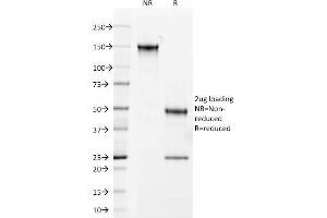 SDS-PAGE Analysis Purified Androgen Receptor Mouse Monoclonal Antibody (AR441). (Androgen Receptor antibody  (AA 302-318))
