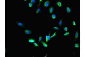 Immunofluorescent analysis of U251 cells using ABIN7158987 at dilution of 1:100 and Alexa Fluor 488-congugated AffiniPure Goat Anti-Rabbit IgG(H+L) (MPDU1 antibody  (AA 1-36))