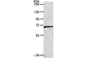 Western blot analysis of Human liver cancer tissue, using SLC22A3 Polyclonal Antibody at dilution of 1:600 (OCT4 antibody)