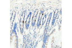 IHC analysis of GIP using anti-GIP antibody (ABIN4886603).