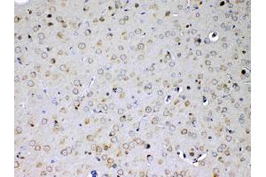 IHC analysis of IL15RA using anti-IL15RA antibody . (IL15RA antibody  (AA 31-174))