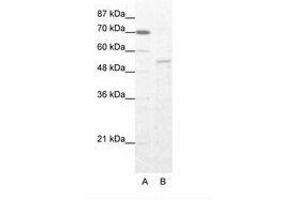 Image no. 1 for anti-Zinc Finger Protein 665 (ZNF665) (AA 146-195) antibody (ABIN202996)