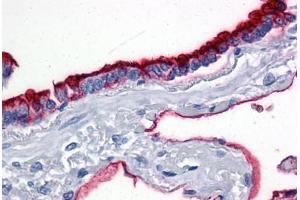 Lung, Human: Formalin-Fixed, Paraffin-Embedded (FFPE) (MUC1 antibody)
