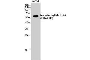Western Blotting (WB) image for anti-Nuclear Factor-kB p65 (NFkBP65) (acLys314), (acLys315) antibody (ABIN3172819) (NF-kB p65 antibody  (acLys314, acLys315))