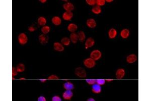 Immunofluorescence analysis of HeLa cells using CYP11B2 Polyclonal Antibody at dilution of 1:100 (40x lens). (CYP11B2 antibody)