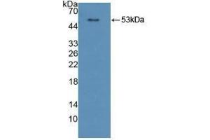 Detection of Recombinant CPR, Human using Polyclonal Antibody to Cytochrome P450 Reductase (CPR) (POR antibody  (AA 77-518))