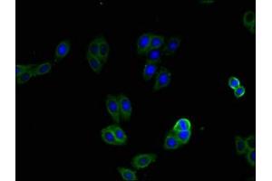 Immunofluorescent analysis of HepG2 cells using ABIN7146099 at dilution of 1:100 and Alexa Fluor 488-congugated AffiniPure Goat Anti-Rabbit IgG(H+L) (CXCR2 antibody  (AA 1-40))
