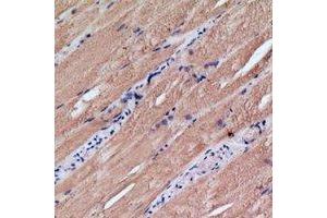 Immunohistochemical analysis of MRPS18C staining in human skeletal muscle formalin fixed paraffin embedded tissue section.