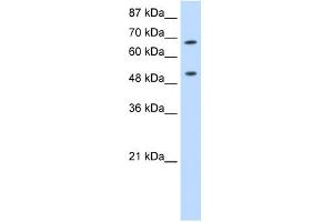 WB Suggested Anti-THOC1 Antibody Titration:  0. (THOC1 antibody  (C-Term))