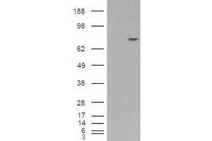 Image no. 2 for anti-Premelanosome Protein (PMEL) (C-Term) antibody (ABIN374704) (Melanoma gp100 antibody  (C-Term))