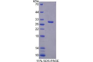 Image no. 1 for Ring Finger Protein 112 (RNF112) (AA 403-647) protein (His tag) (ABIN4988599) (RNF112 Protein (AA 403-647) (His tag))