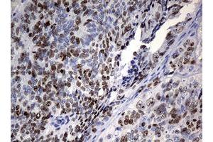 Image no. 2 for anti-Antigen Identified By Monoclonal Antibody Ki-67 (MKI67) (AA 1160-1493) antibody (ABIN1490857) (Ki-67 antibody  (AA 1160-1493))