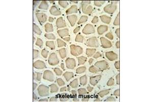 PGP Antibody (N-term) (ABIN653810 and ABIN2843085) IHC analysis in formalin fixed and paraffin embedded skeletal muscle followed by peroxidase conjugation of the secondary antibody and DAB staining. (PGP antibody  (N-Term))