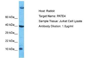 Host: Rabbit Target Name: PATE4 Sample Type: Jurkat Whole Cell lysates Antibody Dilution: 1. (PATE4 antibody  (Middle Region))
