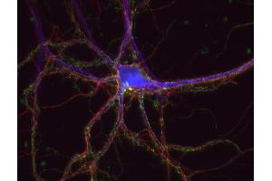 Immunocytochemistry (ICC) image for anti-tau Protein (AA 3-214) antibody (ABIN1742567) (tau antibody  (AA 3-214))