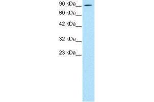 WB Suggested Anti-AEBP1 Antibody Titration: 0. (AEBP1 antibody  (N-Term))