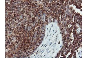 Image no. 7 for anti-Dual Specificity Phosphatase 23 (DUSP23) antibody (ABIN1497930) (DUSP23 antibody)