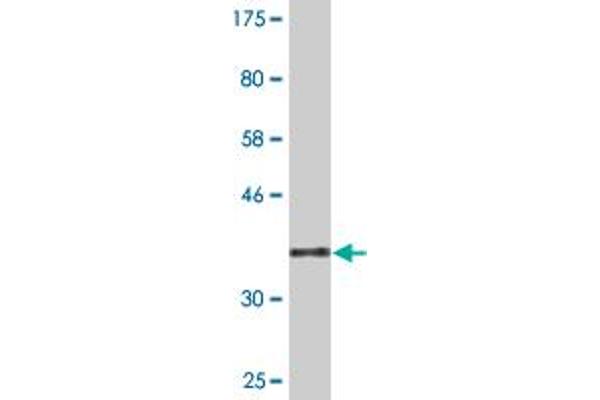 CDY2A antibody  (AA 123-214)