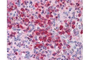 Anti-ELANE / Neutrophil Elastase antibody IHC of human spleen. (ELANE antibody)