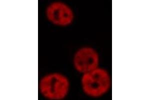 ABIN6276374 staining Hela cells by IF/ICC. (Retinoic Acid Receptor alpha antibody  (N-Term))