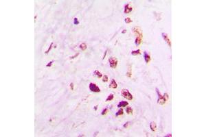 Immunohistochemistry (IHC) image for anti-Tumor Protein P53 (TP53) (C-Term) antibody (ABIN7301404)