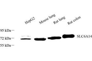 Western Blotting (WB) image for anti-Solute Carrier Family 6 (Amino Acid Transporter), Member 14 (Slc6a14) antibody (ABIN7075677)