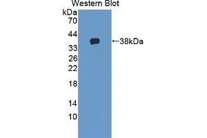 Figure. (Neurocan antibody  (AA 949-1214))