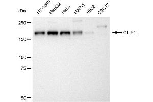 Western blotting analysis using CLIP1 antibody (ABIN7797861).