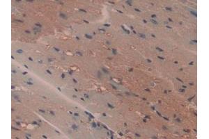 Detection of CYPB in Mouse Heart Tissue using Polyclonal Antibody to Cyclophilin B (CYPB) (PPIB antibody  (AA 34-216))