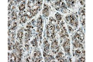 Immunohistochemical staining of paraffin-embedded pancreas tissue using anti-ERCC1 mouse monoclonal antibody. (ERCC1 antibody)