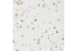 Immunohistochemistry of paraffin-embedded rat brain using PAWR Antibody (ABIN5971565) at dilution of 1/100 (40x lens). (PAWR antibody)
