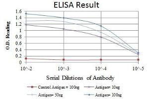 Red: Control Antigen (100 ng), Purple: Antigen (10 ng), Green: Antigen (50 ng), Blue: Antigen (100 ng), (EPH Receptor A10 antibody)