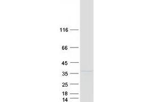Validation with Western Blot