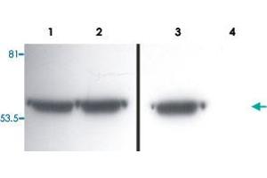 Western Blotting analysis of VIM in whole cell lysate of LEP-19 (human fibroblast cell line) (1, 3) and NIH/3T3 (mouse embryonal fibroblast cell line) (2, 4).